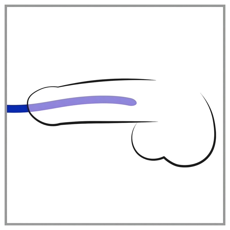 You2Toys - DILATOR - szilikon dilátor szett (3 db) 130181 termék bemutató kép
