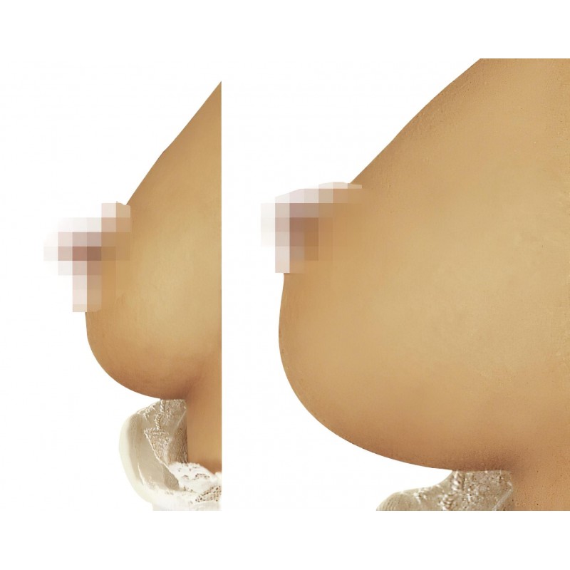 You2Toys - dupla mellpumpa vákuumos stimulációhoz nőknek 157009 termék bemutató kép